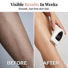 Load image into Gallery viewer, Painless Ipl Hair Removal Device
